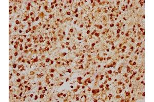 Immunohistochemistry (IHC) image for anti-GA Binding Protein Transcription Factor, alpha Subunit 60kDa (GABPA) (AA 268-372) antibody (ABIN7153409)