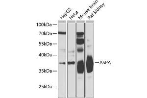 Western blot analysis of extracts of various cell lines, using ASPA Antibody (ABIN6127373, ABIN6137211, ABIN6137212 and ABIN6223094) at 1:500 dilution. (ASPA 抗体  (AA 1-313))