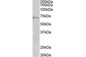 AP31950PU-N DBH antibody staining of Jurkat lysate at 2 µg/ml (35µg protein in RIPA buffer). (DBH 抗体  (Internal Region))