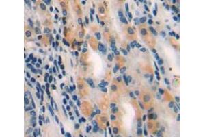 Used in DAB staining on fromalin fixed paraffin-embedded stomach tissue (MYLK3 抗体  (AA 555-786))