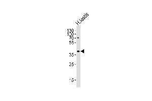 Western blot analysis of lysate from human testis tissue lysate, using TSPY2 Antibody (Center) (ABIN6244122 and ABIN6577495). (TSPY2 抗体  (AA 86-120))