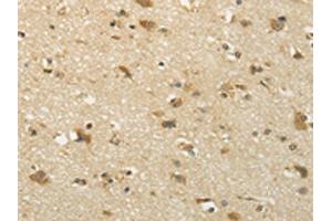 The image on the left is immunohistochemistry of paraffin-embedded Human brain tissue using ABIN7131002(SEMA4F Antibody) at dilution 1/35, on the right is treated with fusion protein. (SEMA4F 抗体)