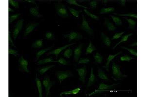 Immunofluorescence (IF) image for anti-Melanoma Antigen Family B, 1 (MAGEB1) (AA 86-195) antibody (ABIN517714)