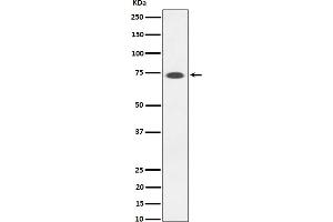 Western blot analysis of SSTR3 expression in Somatostatin Receptor 3 SSTR3 transfected 293T cell lysate.