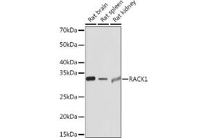 Western blot analysis of extracts of various cell lines, using R Rabbit mAb (ABIN1679360, ABIN3018118, ABIN3018119 and ABIN7101576) at 1:1000 dilution. (GNB2L1 抗体)