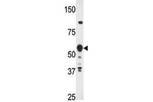 Image no. 1 for anti-Zinc Finger Protein 395 (ZNF395) (Center) antibody (ABIN357344) (ZNF395 抗体  (Center))