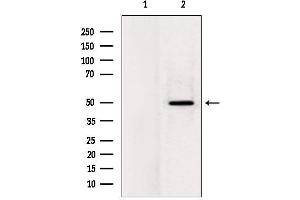 Western blot analysis of extracts from rat heart, using LPCAT2 Antibody. (LPCAT2 抗体  (N-Term))
