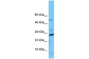 Western Blotting (WB) image for anti-Nudix Hydrolase 8 (NUDT8) (N-Term) antibody (ABIN2791709) (NUDT8 抗体  (N-Term))