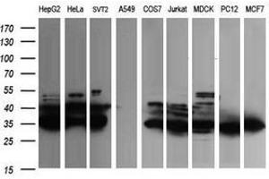 Image no. 1 for anti-Fetal and Adult Testis Expressed 1 (FATE1) antibody (ABIN1498225) (FATE1 抗体)