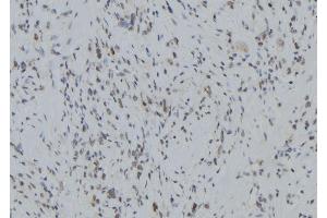 ABIN6279400 at 1/100 staining Human gastric tissue by IHC-P. (RNF123 抗体  (N-Term))