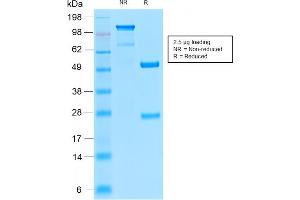 SDS-PAGE Analysis Purified TYRP1 Recombinant Rabbit Monoclonal Antibody (TYRP1/2340R). (Recombinant Tyrosinase-Related Protein 1 抗体  (AA 257-377))