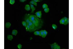 Immunofluorescence staining of MCF-7 cells with ABIN7149870 at 1:133, counter-stained with DAPI. (SAT2 抗体  (AA 1-170))