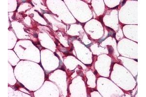 Immunohistochemistry (IHC) image for anti-V-Ets erythroblastosis Virus E26 Oncogene Homolog 1 (Avian) (ETS1) antibody (ABIN1724735)