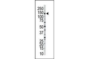 Image no. 1 for anti-Myosin Light Chain Kinase (MYLK) (N-Term) antibody (ABIN360383) (MYLK 抗体  (N-Term))