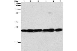 Western Blot analysis of Mouse liver and brain tissue, 293T, A549, A431 and PC3 cell using SIGMAR1 Polyclonal Antibody at dilution of 1:310 (SIGMAR1 抗体)