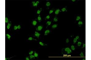 Immunofluorescence of monoclonal antibody to MEOX2 on HeLa cell.