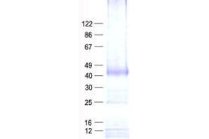 Western Blotting (WB) image for PDLIM1 Interacting Kinase 1 Like (PDIK1L) protein (His tag) (ABIN2728571)