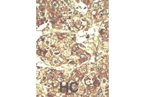 Immunohistochemistry (Paraffin-embedded Sections) (IHC (p)) image for anti-Protein Kinase, CAMP Dependent, Catalytic, beta (PRKACB) (AA 14-43), (N-Term) antibody (ABIN6243845)