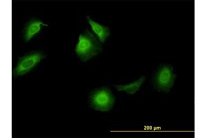 Immunofluorescence of monoclonal antibody to CCT5 on HeLa cell. (CCT5 抗体  (AA 1-541))
