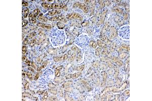 IHC analysis of Glycerol kinase using anti-Glycerol kinase antibody . (Glycerol Kinase 抗体  (AA 1-180))