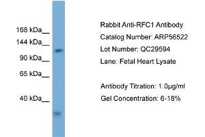 WB Suggested Anti-RFC1  Antibody Titration: 0. (RFC1 抗体  (Middle Region))