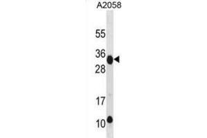 Western Blotting (WB) image for anti-Retinoic Acid Early Transcript 1E (RAET1E) antibody (ABIN3001003) (Retinoic Acid Early Transcript 1E (RAET1E) 抗体)