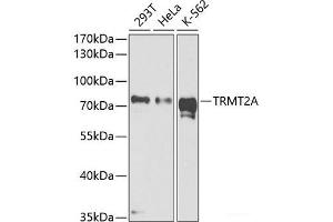 Western blot analysis of extracts of various cell lines using TRMT2A Polyclonal Antibody at dilution of 1:1000. (TRMT2A 抗体)