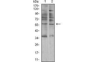 Western Blotting (WB) image for anti-Amylase, alpha 1A (Salivary) (AMY1A) (AA 172-284) antibody (ABIN5611200)
