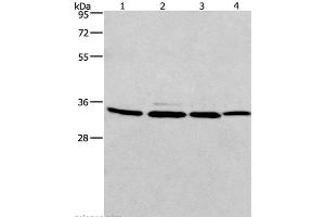 Western Blot analysis of A549, 231, PC3 and hela cell using MAD2L1BP Polyclonal Antibody at dilution of 1:675 (MAD2L1BP 抗体)