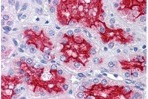 Human Kidney: Formalin-Fixed, Paraffin-Embedded (FFPE) (Peroxiredoxin 4 抗体  (AA 51-151))