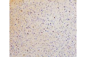 IHC analysis of SMARCAD1 using anti-SMARCAD1 antibody (ABIN6719539).