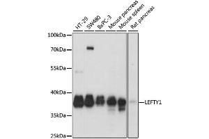 Western blot analysis of extracts of various cell lines, using LEFTY1 antibody. (LEFTY1 抗体)