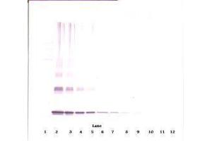 Image no. 3 for anti-Interleukin 10 (IL10) antibody (ABIN465277) (IL-10 抗体)