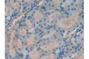 DAB staining on IHC-P; Samples: Rat Kidney Tissue (TIMP2 抗体  (AA 27-220))