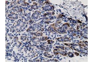 Immunohistochemical staining of paraffin-embedded Human breast tissue using anti-CRYM mouse monoclonal antibody. (CRYM 抗体)