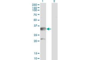 Western Blotting (WB) image for anti-Carbonyl Reductase 3 (CBR3) (AA 180-277) antibody (ABIN514083)