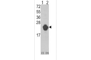 Western blot analysis of IL1RN using rabbit polyclonal IL1RN Antibody using 293 cell lysates (2 ug/lane) either nontransfected (Lane 1) or transiently transfected with the IL1RN gene (Lane 2). (IL1RN 抗体  (AA 100-129))