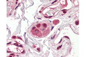 Anti-Groucho antibody IHC of human colon, submucosal plexus. (AES 抗体  (AA 79-91))