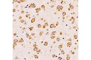 Immunohistochemistry of paraffin embedded mouse brain using UQCC (ABIN7076094) at dilution of 1: 1000 (400x lens) (Ubiquinol-Cytochrome C Reductase Complex Chaperone (UQCC) 抗体)