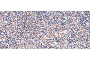 Immunohistochemistry of paraffin-embedded Human tonsil tissue using OSBPL2 Polyclonal Antibody at dilution of 1:55(x200) (OSBPL2 抗体)