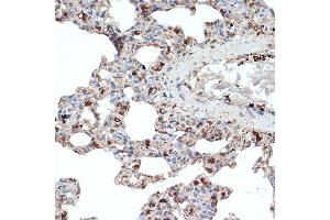 Immunohistochemistry of paraffin-embedded rat lung using SR-B2/SR-B2/LIMPII Rabbit mAb (ABIN7270157) at dilution of 1:100 (40x lens). (SCARB2 抗体)