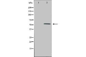 Western blot analysis of extracts from HepG2 cells, using UEVLD antibody. (UEVLD 抗体  (N-Term))