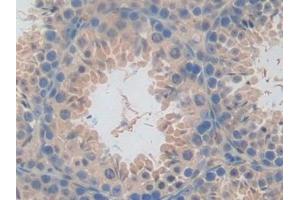 Immunohistochemistry (IHC) image for anti-C-Type Lectin Domain Family 10, Member A (CLEC10A) (AA 69-273) antibody (ABIN7441913)