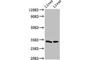 Western Blot Positive WB detected in: Rat liver tissue, Mouse liver tissue All lanes: RGN antibody at 3 μg/mL Secondary Goat polyclonal to rabbit IgG at 1/50000 dilution Predicted band size: 34, 25 kDa Observed band size: 34 kDa (Regucalcin 抗体  (AA 1-299))
