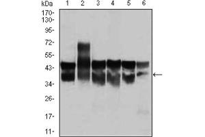 Western blot analysis using CDK2 antibody against Jurkat (1), HL-60 (2), K562 (3), A431 (4), HeLa (5), and NIH3T3 (6) cell lysate. (CDK2 抗体)