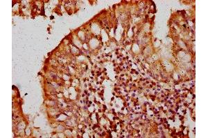 Immunohistochemistry (IHC) image for anti-T-Cell, Immune Regulator 1, ATPase, H+ Transporting, Lysosomal V0 Subunit A3 (TCIRG1) (AA 76-182), (Isoform 3) antibody (ABIN7175220)