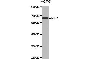 Western blot analysis of extracts of MCF-7 cell line, using PKR antibody. (EIF2AK2 抗体)