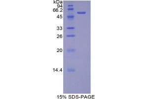 SDS-PAGE analysis of Rat bACE2 Protein. (BACE2 蛋白)