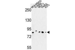 Western Blotting (WB) image for anti-Chondroitin Polymerizing Factor (CHPF) antibody (ABIN3004012) (CHPF 抗体)