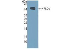 Detection of Recombinant MUC1, Human using Polyclonal Antibody to Mucin 1 (MUC1) (MUC1 抗体  (AA 1098-1255))